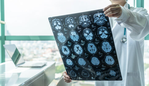 Doctor examines brain X-ray images near a window.
